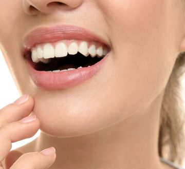What You Need to Know About Dental Crowns