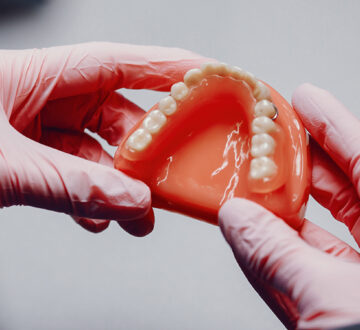 The 5 Common Types of Dental Bridges