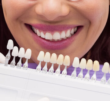 Comprehensive Understanding of Porcelain Veneers