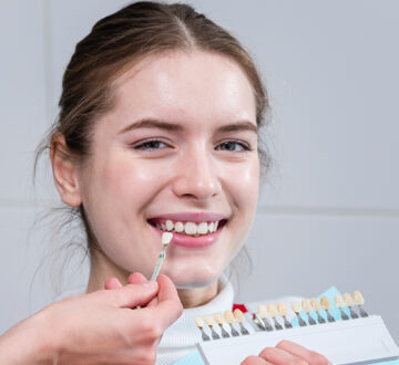 Veneers and Porcelain Crowns: Which Is Best for Your Needs and What Is the Difference?