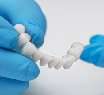 Why You Should Get A Dental Bridge