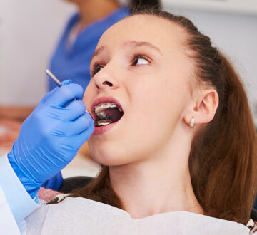 Oral Cancer Screenings for Healthy People: Are They Necessary?
