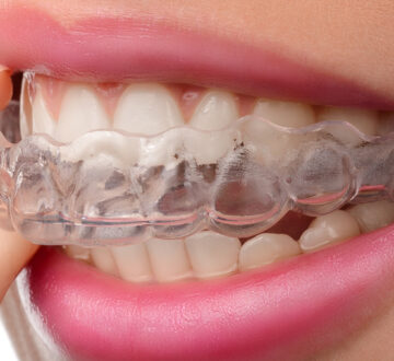 Everything You Should Know About ClearCorrect