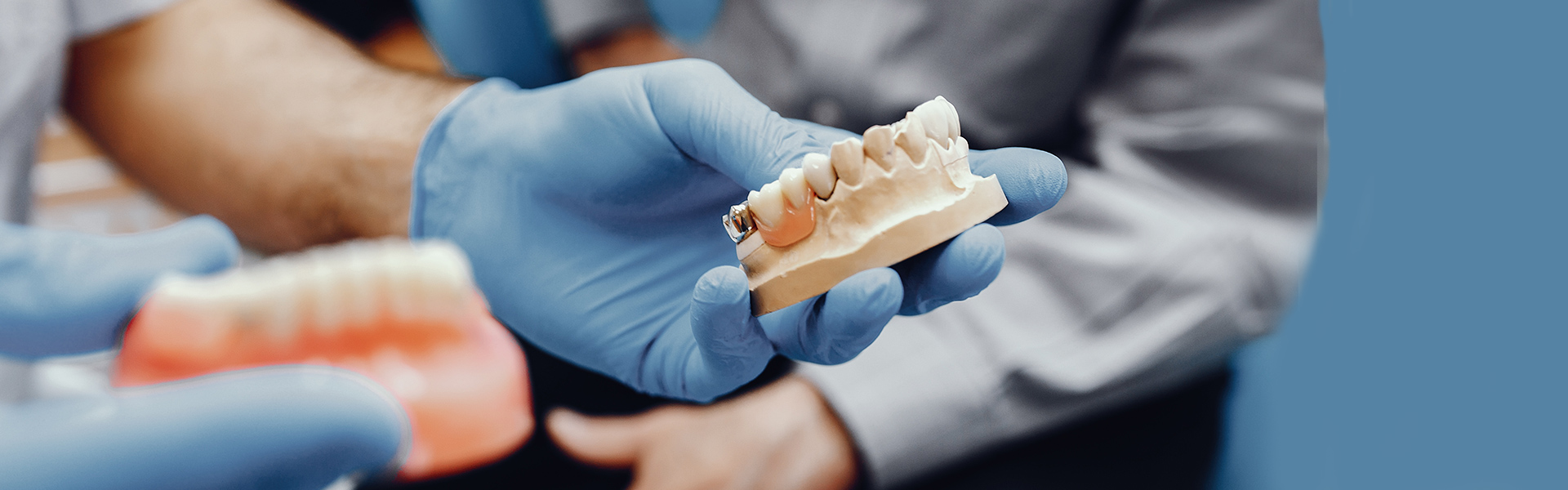 Why Consider the Five Health Benefits of Dental Bridges?
